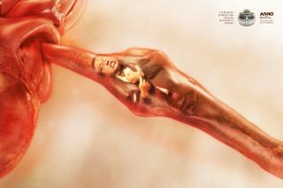 Arno: Clogged Arteries - Boss